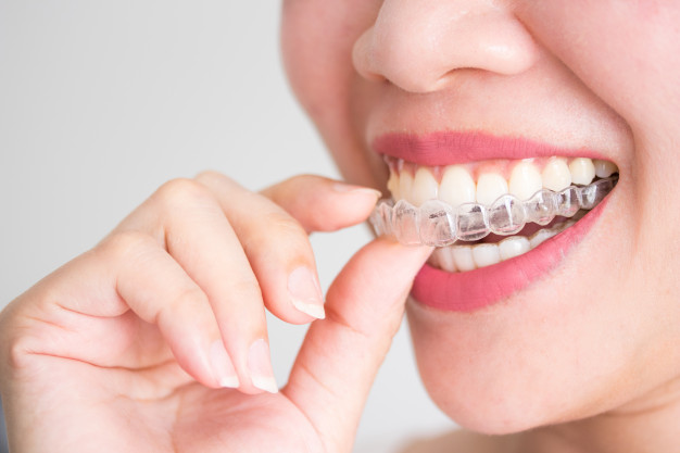 zacht Overeenkomstig cursief All you Need to Know About Invisalign Aligners - Comfortho Invisalign ortho